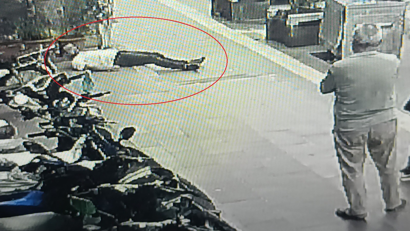 Kafasını Çöp Konteynerine Çarptı, Kimse Hastaneye Gitmeye Ikna Edemedi (4)
