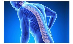 Osteoporoz için 'Kemiğiniz kırılmadan önlem alın' uyarısı