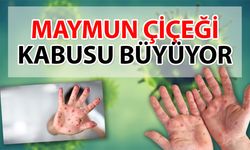 Tehlike çanları çalıyor! 'Maymun Çiçeği' alarmı! Yeni kabusumuz 'Maymun Çiçeği' virüsü!