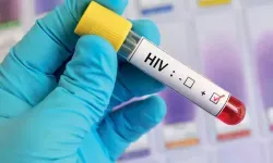 Prof. Dr. Taşova, HIV olgusu 2012 yılından bu yana 4 kat arttı