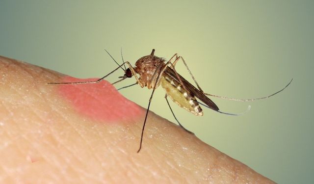 Bu yöntemler sivrisinek kaşıntılarına son veriyor