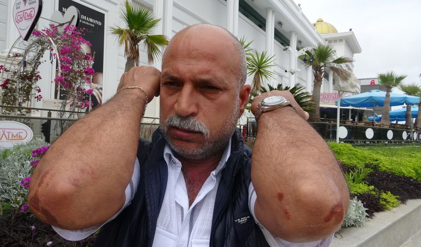 Antalya’da akıl almaz saldırı! Tek suçu beklemekti